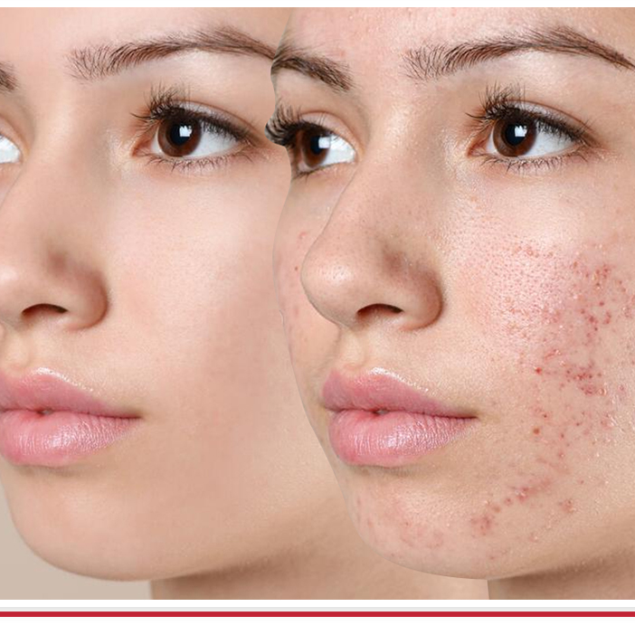 Clear Skin Solutions Mumbai