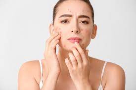Skin Rash Diagnosis treatment Malad Mumbai