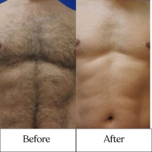 Cosderma_Clinic_Before_After_10