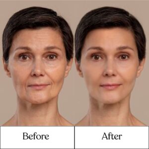 Cosderma_Clinic_Before_After_7
