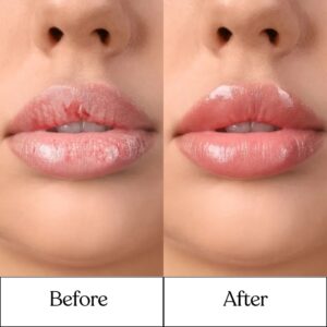 Cosderma_Clinic_Before_After_8