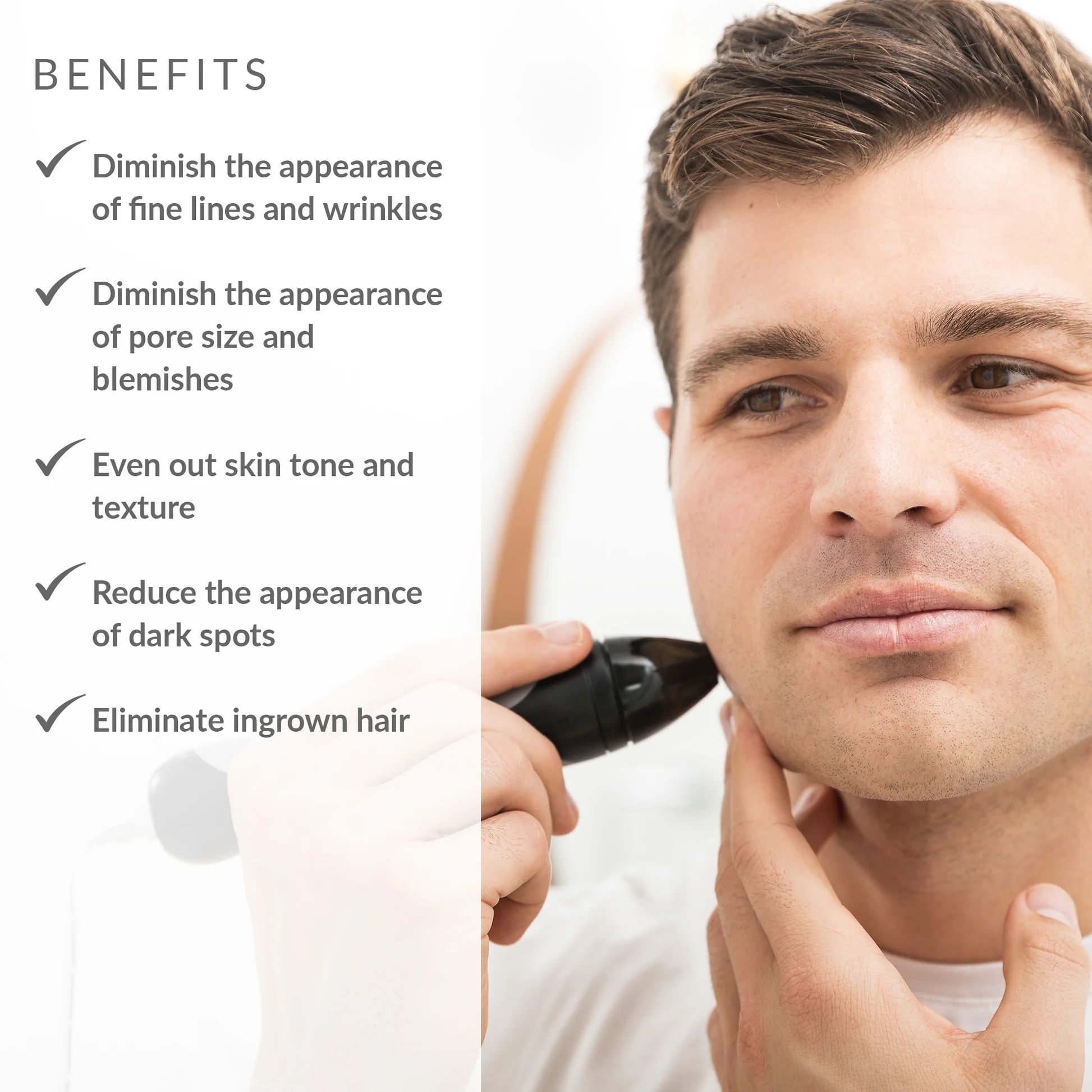 Microdermabrasion Treatment Benefits Malad mumbai clinic