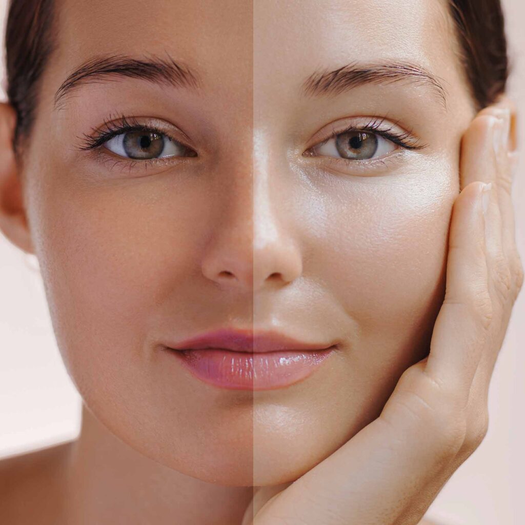 Benefits of Whitening Facial Treatment​ malad mumbai