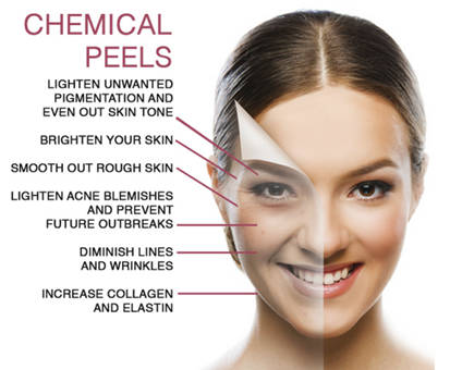Best Chemical Peels Clinic Malad Mumbai