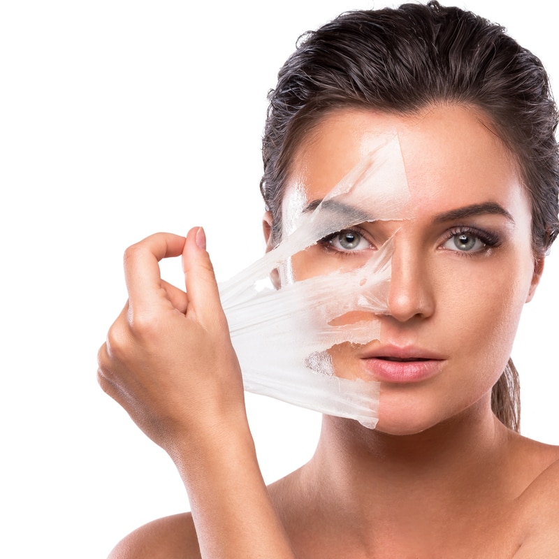 Best Pigmentation Peel Cosmelana Peel Clinic Malad Mumbai