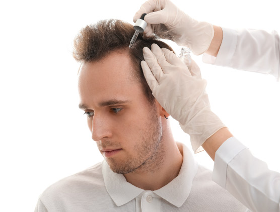 Hair-Transplant-about-f9c9cb7bc5182c72