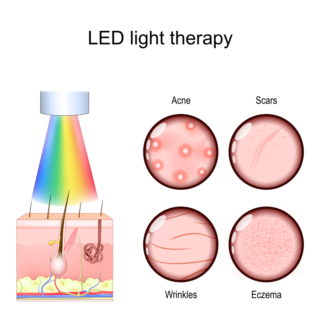 Benefits of LED Light Therapy Cosderma clinic malad mumbai