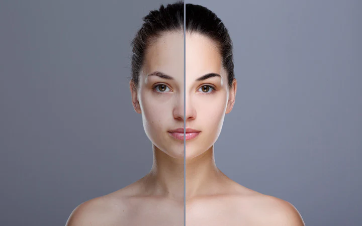 Skin Smoothing Treatment Mumbai