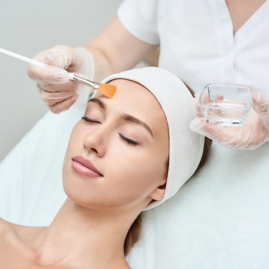 Chemical Peels for Acne PIH Glow Results Cosderma Mumbai