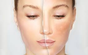 Skin Smoothing clinic malad Mumbai