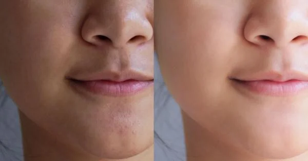 Best Skin Brightening Clinic Malad mumbai
