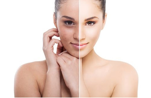 Skin Rejuvenation Treatment Mumbai