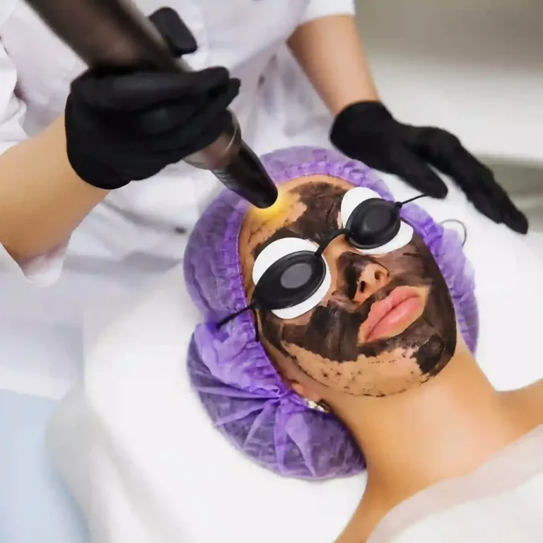 Carbon Hollywood Facial in Malad Mumbai