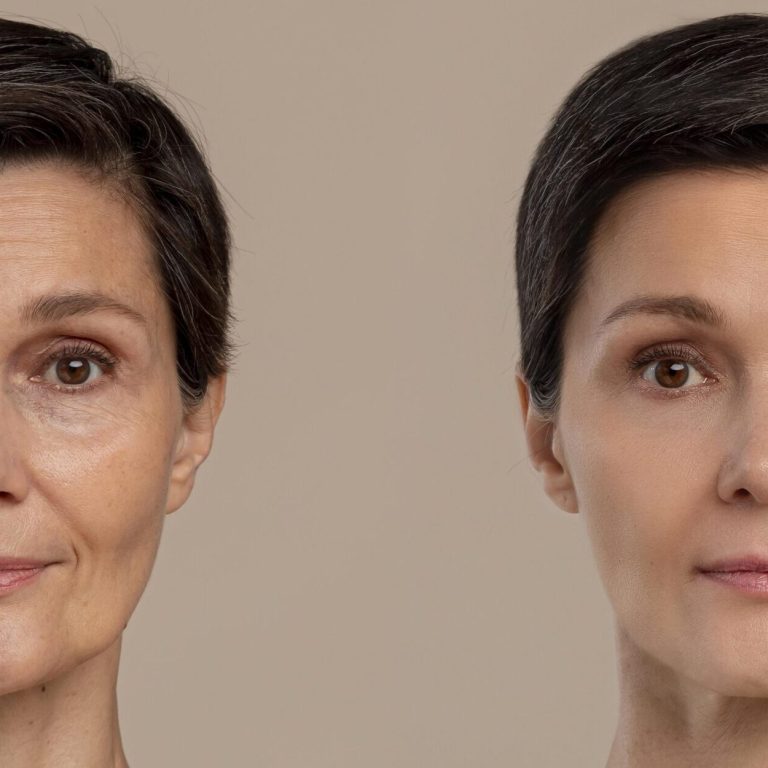 antiaging-beauty-treatment