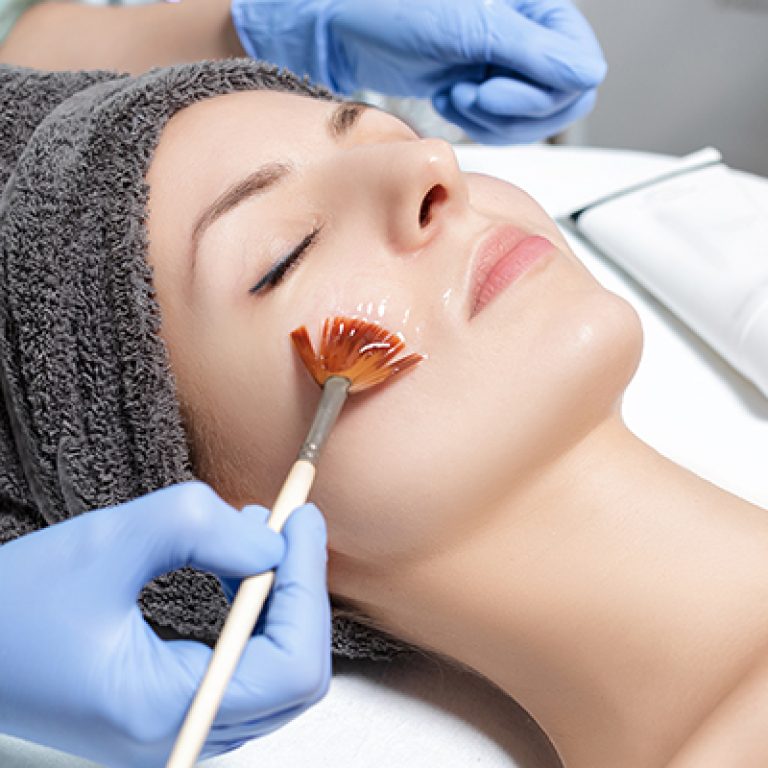 Chemical Peels for Acne PIH Glow | Cosderma Malad Mumbai