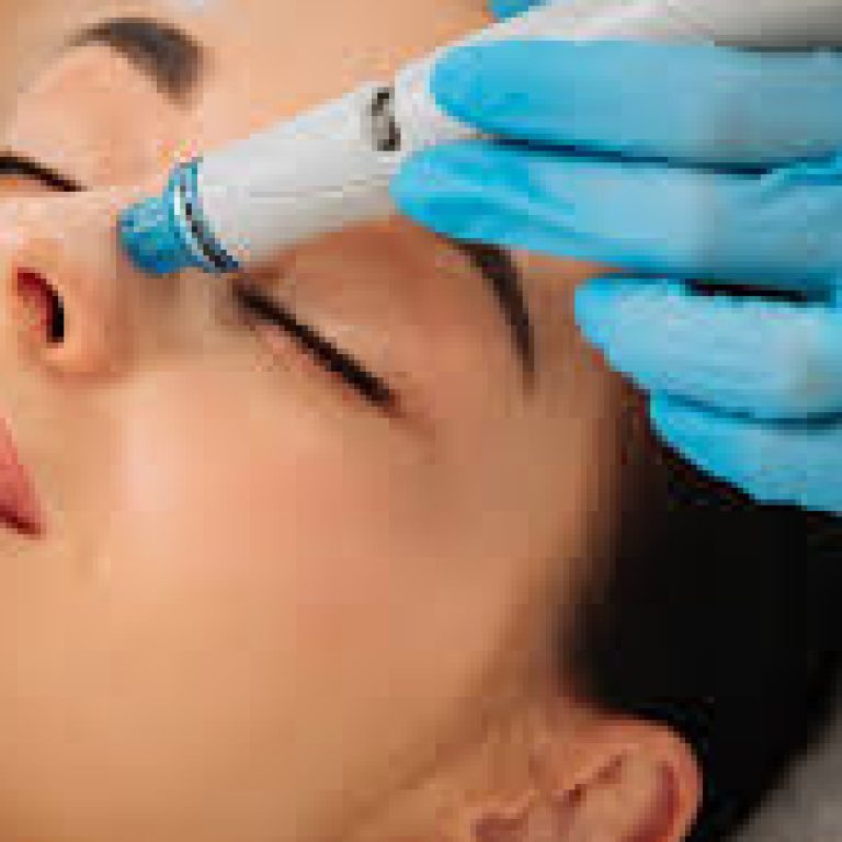 Best HydraFacial Treatment in Malad, Mumbai