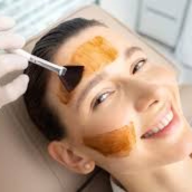 Cosmelan Peel in Malad Mumbai | Melasma & Pigmentation