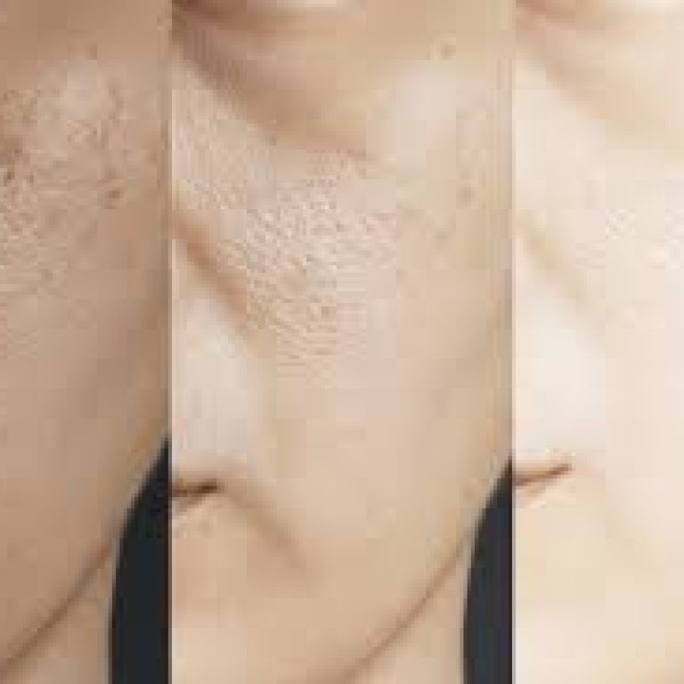 Best Skin Brightening Clinic Malad mumbai