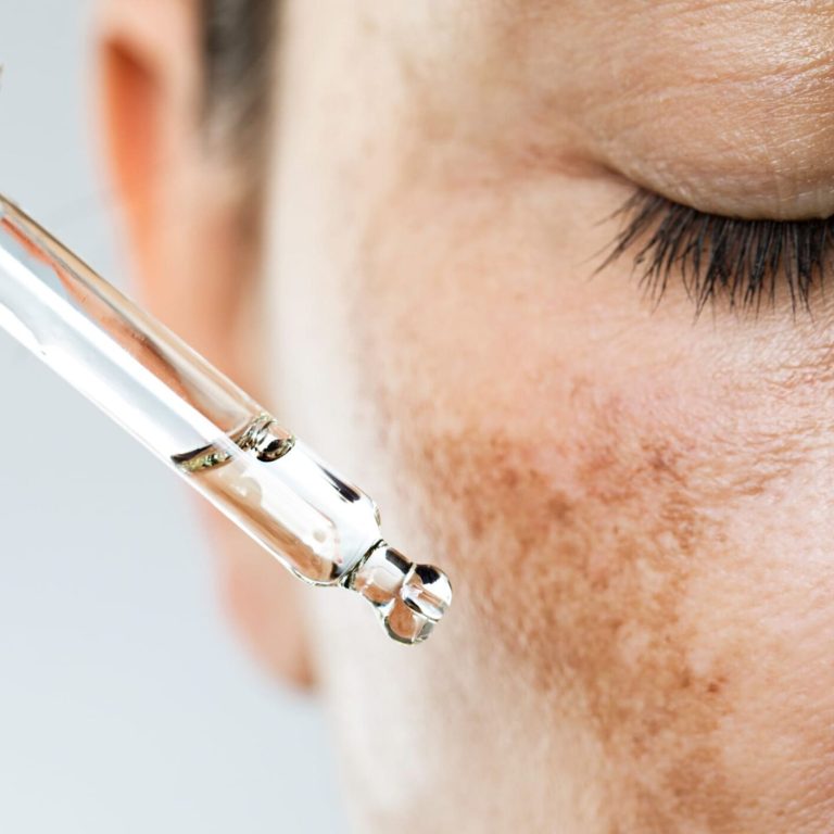 Carbon Hollywood Facial in Malad Mumbai