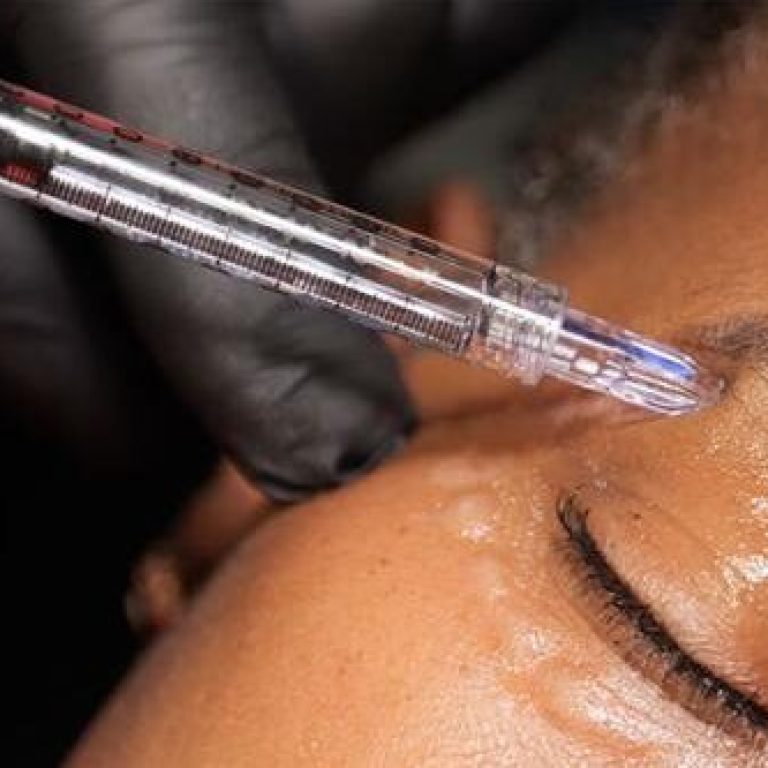 NCTF 135 HA: Skin booster and Rejuvenate in Melbourne